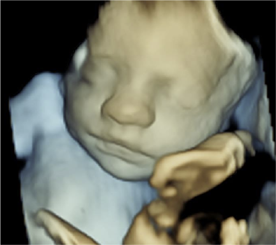 3D/4D Ultrasound – Earlyview