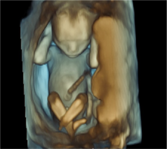 3D/4D Ultrasound – Earlyview